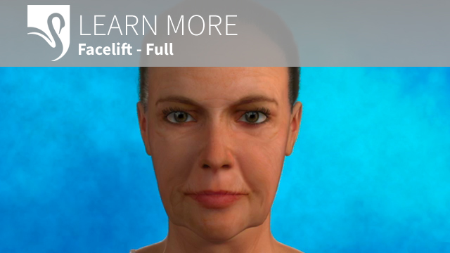 Facial Rejuvenation - Face Lift - Ocala Plastic Surgery